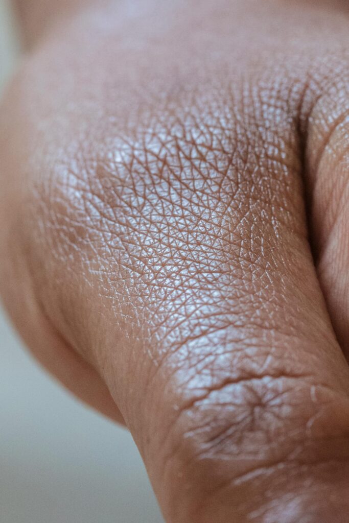 dehydrated skin vs dry skin