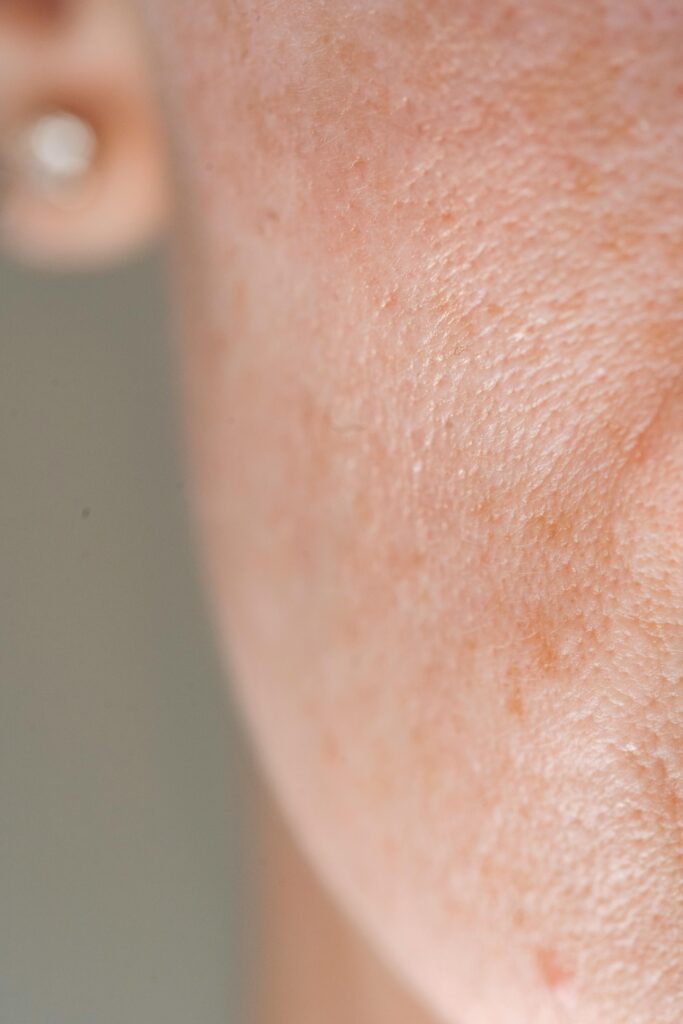 how to know your skin type at home