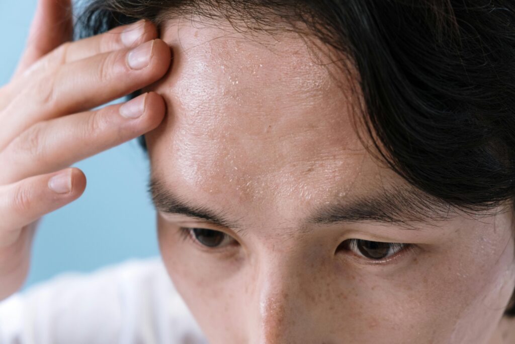 niacinamide benefits for skin
