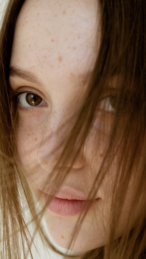 how to get rid of dark spots on face