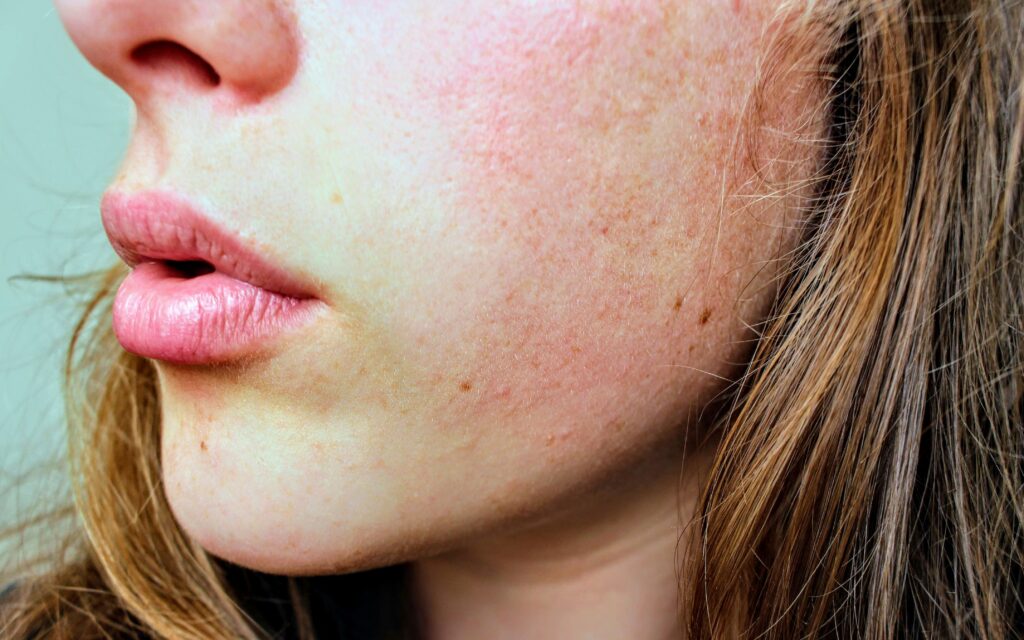 how to get rid of dark spots on face