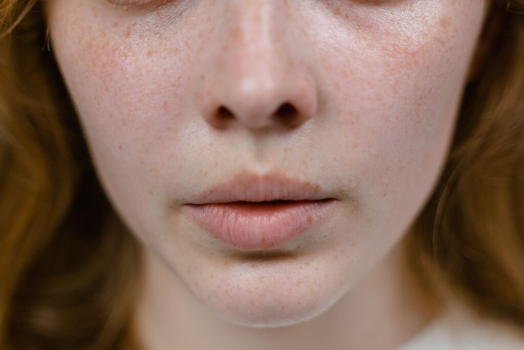how to get rid of dark spots on face